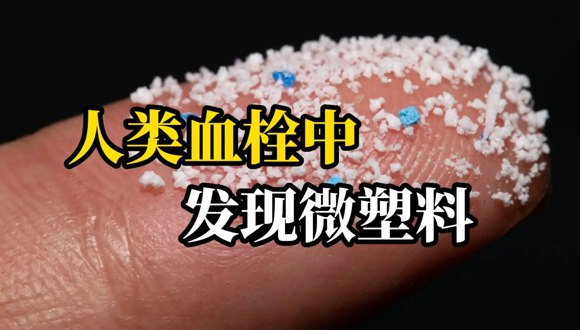 震驚（jīng）！人類血栓中首次發現微塑料！